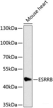 Immunohistochemistry of paraffin-embedded Rat testis using HFM1 Polyclonal Antibody at dilution of 1:100 (40x lens).