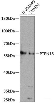 Immunofluorescence analysis of C6 cells using MCTS1 Polyclonal Antibody at dilution of 1:100 (40x lens). Blue: DAPI for nuclear staining.