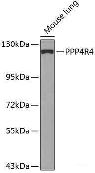 Immunohistochemistry of paraffin-embedded Rat lung using RPL22 Polyclonal Antibody at dilution of 1:100 (40x lens).