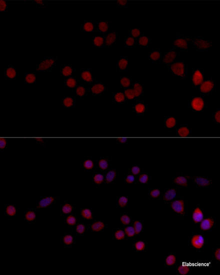 Western blot analysis of extracts of various cell lines using OAS3 Polyclonal Antibody at dilution of 1:3000.