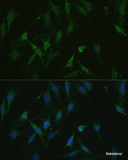 Western blot analysis of extracts of various cell lines using ERC1 Polyclonal Antibody at dilution of 1:3000.