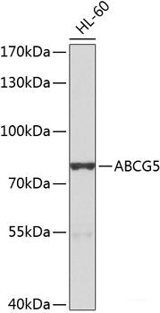 Immunohistochemistry of paraffin-embedded Rat liver using PHOX2B Polyclonal Antibody at dilution of 1:100 (40x lens).