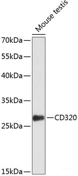 Immunohistochemistry of paraffin-embedded Human prostate using MTERFD1 Polyclonal Antibody at dilution of 1:100 (40x lens).
