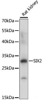 Western blot analysis of extracts of various cell lines using OTC Polyclonal Antibody at dilution of 1:1000.