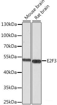 Immunohistochemistry of paraffin-embedded Mouse kidney using AIP Polyclonal Antibody at dilution of 1:100 (40x lens).