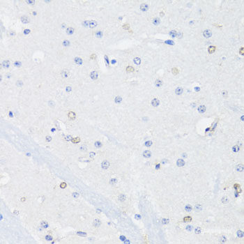Western blot analysis of extracts of various cell lines using CDY1 Polyclonal Antibody at dilution of 1:1000.