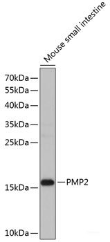 Western blot analysis of extracts of various cell lines using MRC2 Polyclonal Antibody at dilution of 1:1000.