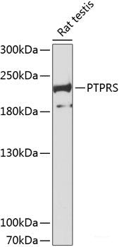 Western blot analysis of extracts of U-251MG cells using KCNE2 Polyclonal Antibody at dilution of 1:1000.