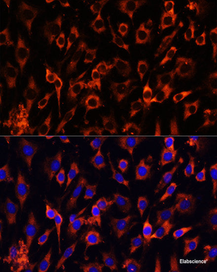 Western blot analysis of extracts of H460 cells using STRA13 Polyclonal Antibody at dilution of 1:1000.