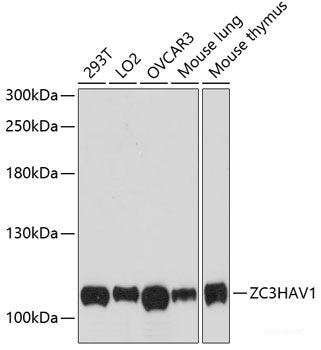 Western blot analysis of extracts of various cell lines using SERPINF2 Polyclonal Antibody at dilution of 1:1000.