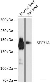 Western blot analysis of extracts of various cell lines using EIF3K Polyclonal Antibody at dilution of 1:1000.