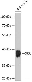 Western blot analysis of extracts of various cell lines using DET1 Polyclonal Antibody at dilution of 1:1000.