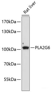 Western blot analysis of extracts of 293 and HeLa cells using Phospho-AKT(T450) Polyclonal Antibody at dilution of 1:1000. 293 cells were treated by Insulin (100nM) for 10 minutes after serum-starvation overnight. HeLa cells were treated by EGF (100ng/ml) for 30 minutes after serum-starvation overnight.