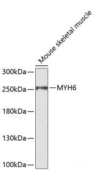 Western blot analysis of extracts of HT-29 and HeLa cells using Phospho-CDK1(Y15) Polyclonal Antibody at dilution of 1:1000. HT-29 cells were treated by serum-starvation overnight. HeLa cells were treated by UV for 15-30 minutes.