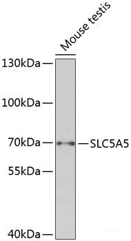 Western blot analysis of extracts of HeLa cells using Phospho-GSK3B(S9) Polyclonal Antibody at dilution of 1:2000. HeLa cells were treated by Calyculin A (100nM) for 30 minutes after serum-starvation overnight.