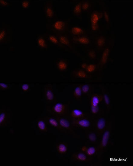 Immunofluorescence analysis of MCF-7 cells using Phospho-c-Jun(S63) Polyclonal Antibody