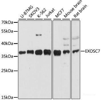 Western blot analysis of extracts of 3T3L1 cells using Phospho-MAPK14(Y182) Polyclonal Antibody at dilution of 1:1000.