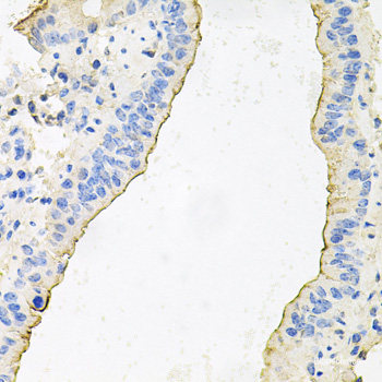 Western blot analysis of extracts of Jurkat cells using Phospho-MAPK3(Y204) Polyclonal Antibody at dilution of 1:2000.