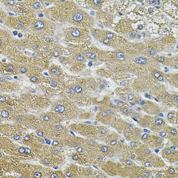 Western blot analysis of extracts of HeLa cells using Phospho-HSPB1(S78) Polyclonal Antibody at dilution of 1:1000. HeLa cells were treated by UV for 15-30 minutes or treated by serum-starvation overnight or treated by Anisomycin (25ug/ml) for 30 minutes after serum-starvation overnight.