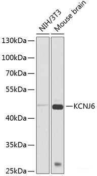 Western blot analysis of extracts from 293 cells using Phospho-PTPN11(Y542) Polyclonal Antibody.