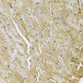 Western blot analysis of extracts from MDA-MB-435 cells using Phospho-EIF4EBP1(T36) Polyclonal Antibody.