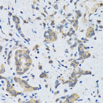 Western blot analysis of extracts from HeLa cells using Phospho-STAT6(Y641) Polyclonal Antibody.