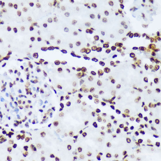 Immunofluorescence analysis of methanol-fixed HeLa cells using Phospho-ZAP70(Y319) Polyclonal Antibody