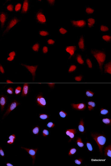 Western blot analysis of extracts of Jurkat cells using Phospho-ZAP70(Y493) Polyclonal Antibody at dilution of 1:5000.