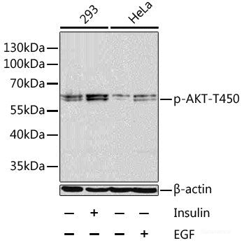 Immunofluorescence analysis of U2OS cells using Phospho-ESPL1(S1126) Polyclonal Antibody