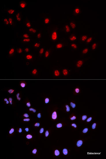 Immunohistochemistry of paraffin-embedded Rat lung using Phospho-ERK1(T202/Y204)/ ERK2(T185/Y187) Polyclonal Antibody at dilution of 1:100 (40x lens).
