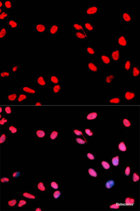 Immunohistochemistry of paraffin-embedded Rat lung using Phospho-Stat3(S727) Polyclonal Antibody at dilution of 1:100 (40x lens).