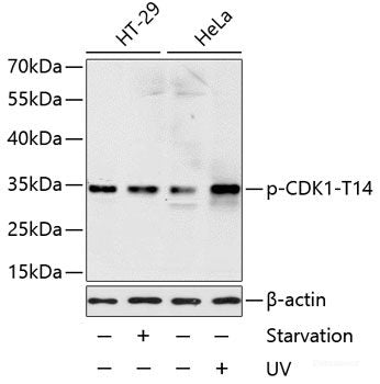 Western blot analysis of extracts of HeLa cells using Phospho-NF-kB p65(S536) Polyclonal Antibody at dilution of 1:1000. HeLa cells were treated by TNF-α (20ng/ml) for 30 minutes.