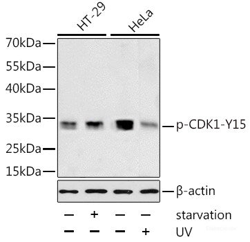 Western blot analysis of extracts of 293 and HT-29 cells using Phospho-p53(S46) Polyclonal Antibody at dilution of 1:1000. 293 cells were treated by UV for 15-30 minutes. HT-29 cells were treated by UV for 15-30 minutes.