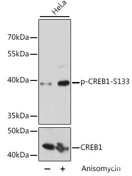 Western blot analysis of extracts of Jurkat cells using Phospho-SRC Family(Y416) Polyclonal Antibody at dilution of 1:1000.