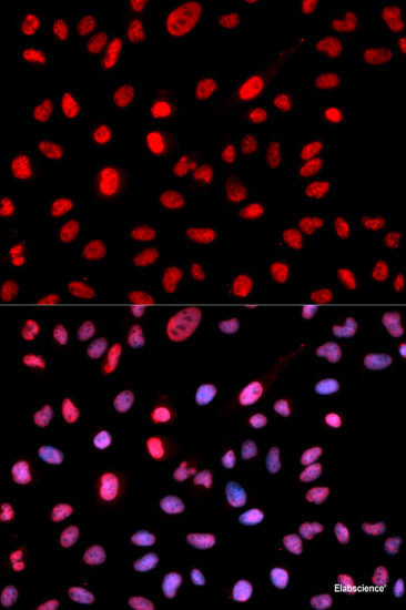 Western blot analysis of extracts of 293T cells using Phospho-PKC (pan) (βII Ser660) Polyclonal Antibody at dilution of 1:1000.