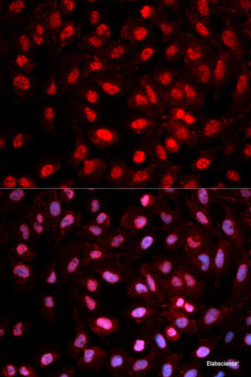 Western blot analysis of extracts of HeLa cells using Phospho-RAF1(S259) Polyclonal Antibody at dilution of 1:1000. HeLa cells were treated by 10% FBS after serum-starvation overnight.