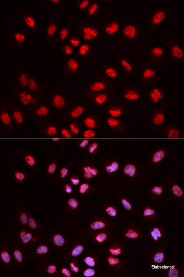 Western blot analysis of extracts of Jurkat cells using Phospho-Syk(Y352)/ZAP70(Y319) Polyclonal Antibody at dilution of 1:1000.