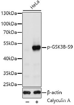 Western blot analysis of extracts of SKOV3 cells using Phospho-eNOS(S1177) Polyclonal Antibody.