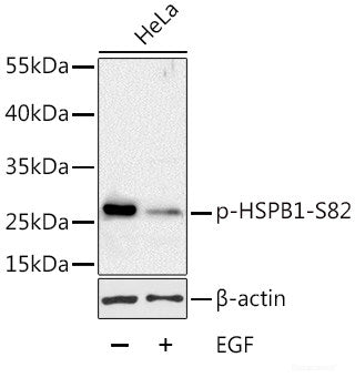 Western blot analysis of extracts of 293T cells using Phospho-β-catenin(S33/S37/T41) Polyclonal Antibody.