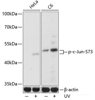 Immunohistochemistry of paraffin-embedded Rat brain using Phospho-ATF2(T69/T71) Polyclonal Antibody at dilution of 1:100 (40x lens).