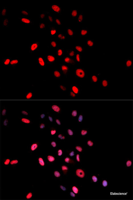 Western blot analysis of extracts of various cell lines using Phospho-FLT3(Y589/591) Polyclonal Antibody.