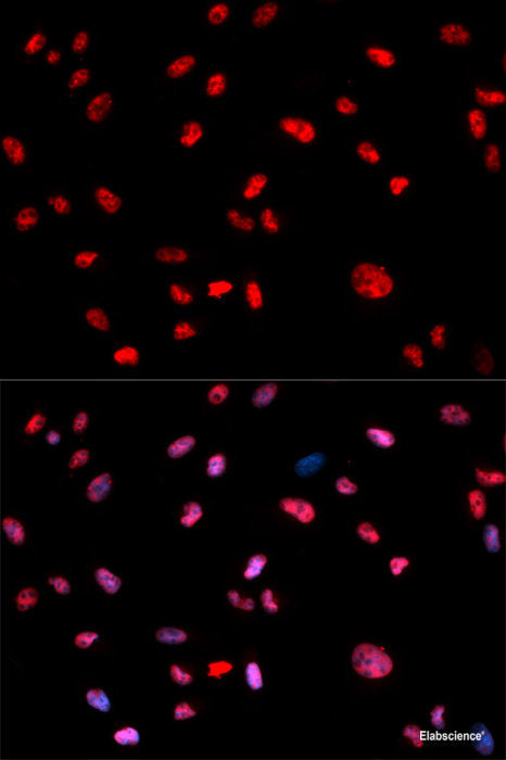 Western blot analysis of extracts of UT7 cells using Phospho-Jak2(Y1007/1008) Polyclonal Antibody.