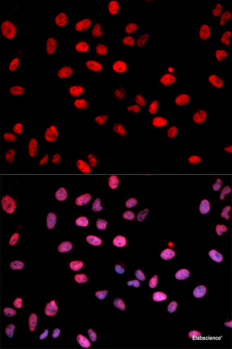 Western blot analysis of extracts of 293T cells using Phospho-Jak3(Y980/981) Polyclonal Antibody.