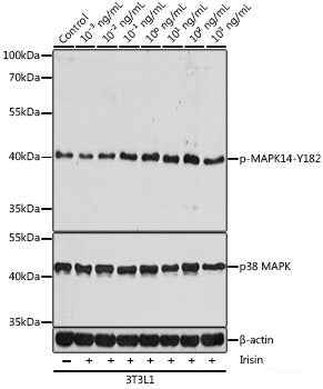Western blot analysis of extracts of various cell lines using Phospho-RPS6(S240/244) Polyclonal Antibody at dilution of 1:1000.