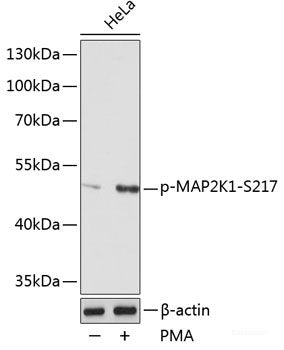Western blot analysis of extracts of A431 cells using Phospho-P90RSK(T359/S363) Polyclonal Antibody.