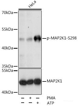 Western blot analysis of extracts of HeLa cells using Phospho-IKKα/β(S176/180) Polyclonal Antibody.
