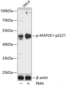 Western blot analysis of extracts of HeLa cells using Phospho-Smad2(S465/467)/Smad3(S423/425) Polyclonal Antibody at dilution of 1:1000.