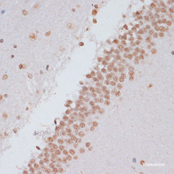 Western blot analysis of extracts of Mouse brain using Phospho-IRS1(S307) Polyclonal Antibody at dilution of 1:500.