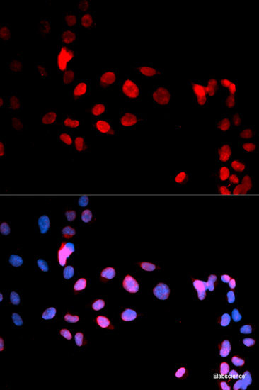 Western blot analysis of extracts of PC-12 cells using Phospho-SMAD3(T179) Polyclonal Antibody at dilution of 1:1000. PC-12 cells were treated by TNF-α (20 ng/ml) at 37°C for 30 minutes after serum-starvation overnight.