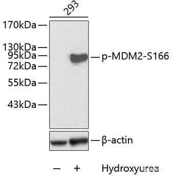 Western blot analysis of extracts of NIH/3T3 cells using Phospho-PDGFR beta(Y740) Polyclonal Antibody.